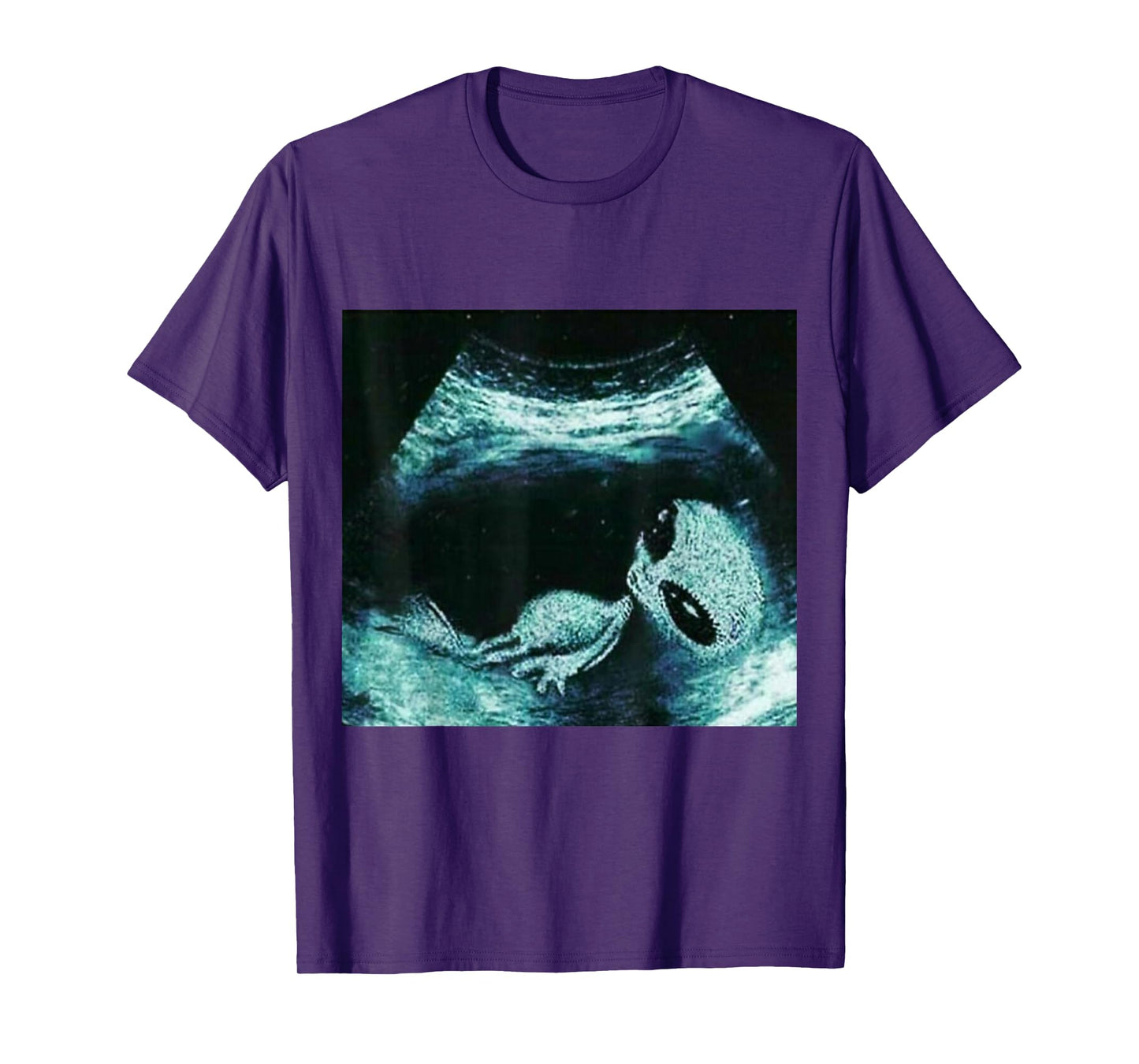 Funny Alien Xray Meme Brainrot T-Shirt