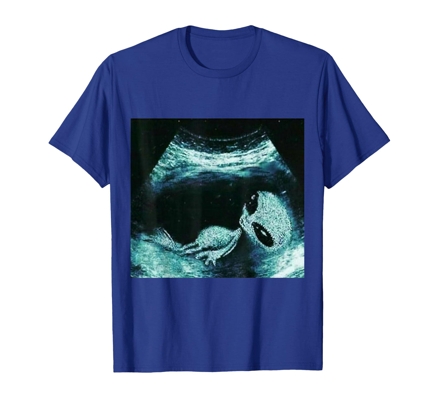 Funny Alien Xray Meme Brainrot T-Shirt